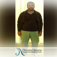 Antonio Jesús operado en Obesidad Almería