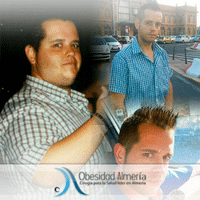 Diego operado en Obesidad Almería